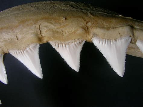dente de tubarão - o que é bom para dor de dente